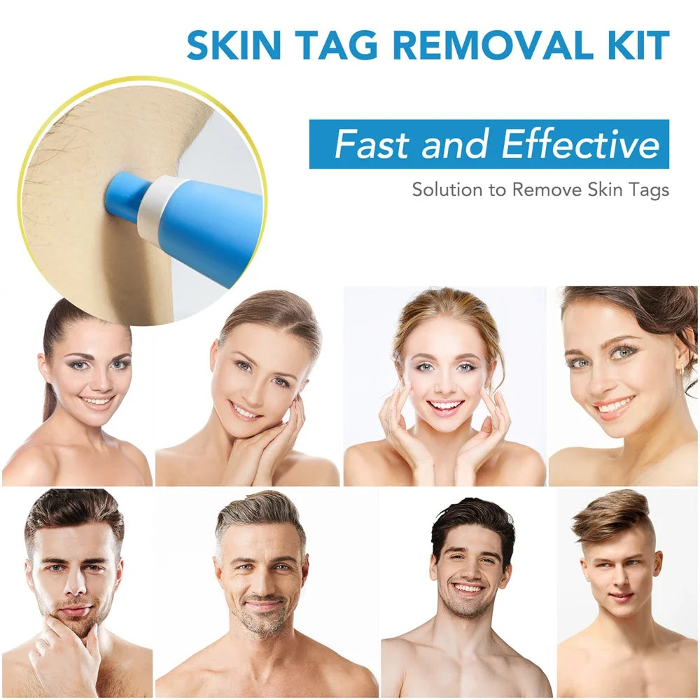 2-in-1 Auto Micro Skin Tag & Mole Remover Kit