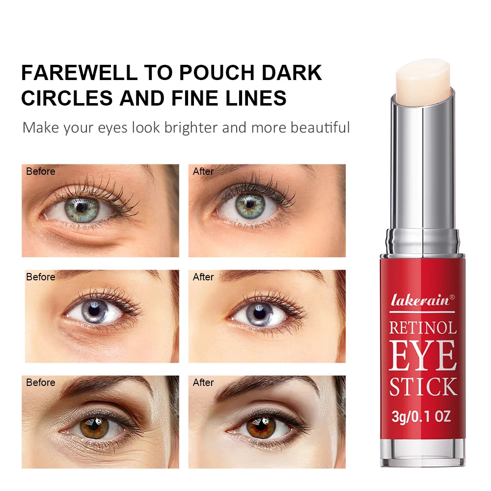 Retinol Eye Cream Stick for Dark Circles & Firming