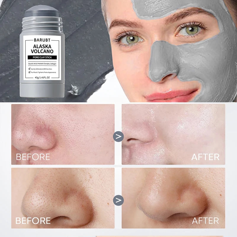 Mugwort Pore Cleansing Stick – Blackhead & Blemish Treatment