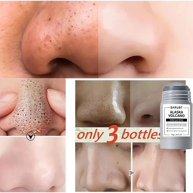 Mugwort Pore Cleansing Stick – Blackhead & Blemish Treatment